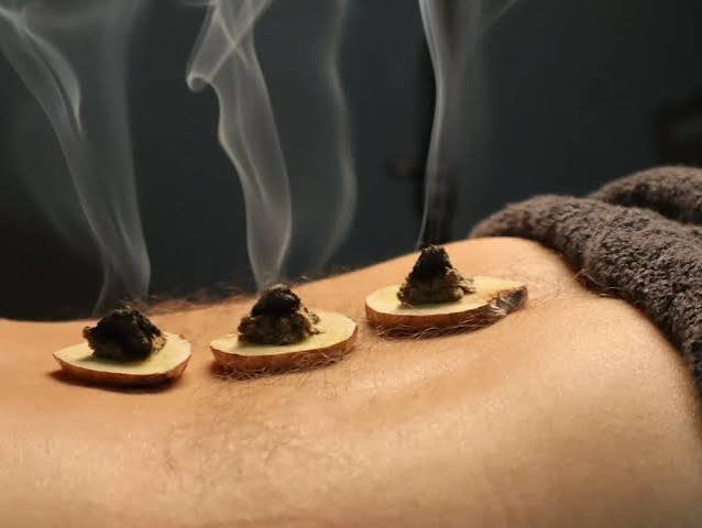 Moxibustion Therapy